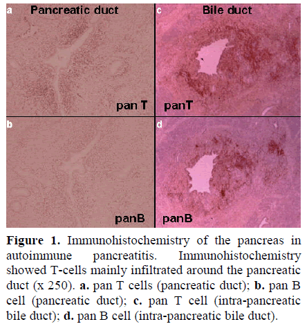 pancreas-immunohistochemistry-autoimmune