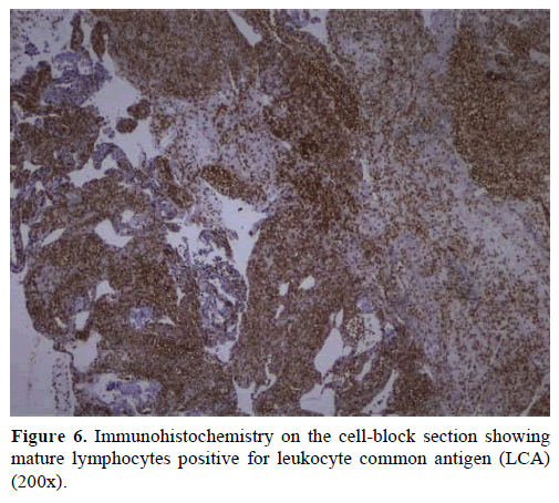 pancreas-immunohistochemistry-leukocyte