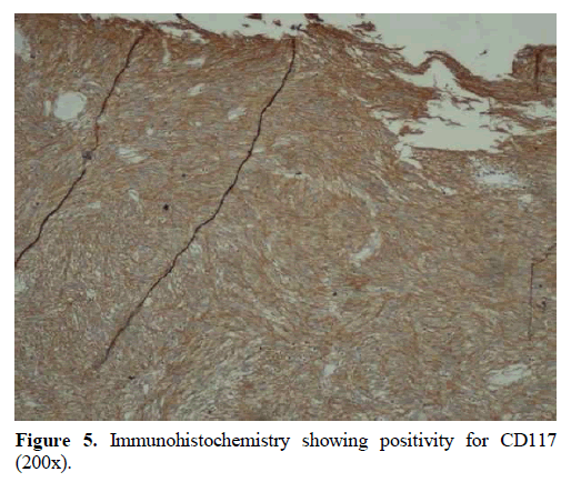 pancreas-immunohistochemistry-positivity