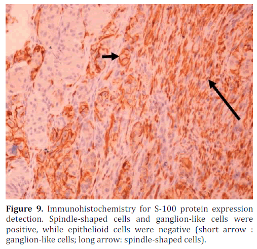 pancreas-immunohistochemistry-protein-ganglion