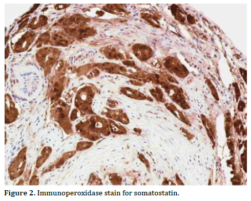 pancreas-immunoperoxidase-stain-somatostatin