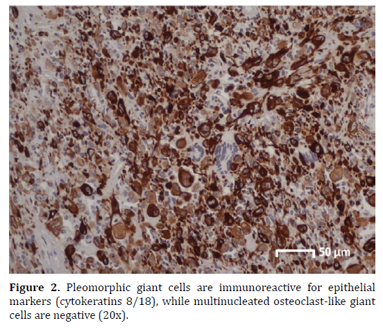 pancreas-immunoreactive