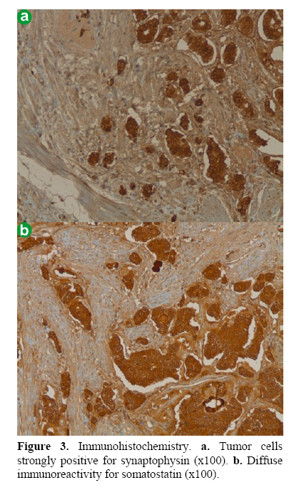 pancreas-immunoreactivity-somatostatin