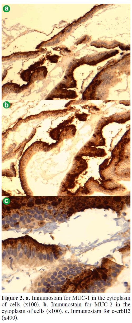 pancreas-immunostain-cytoplasm