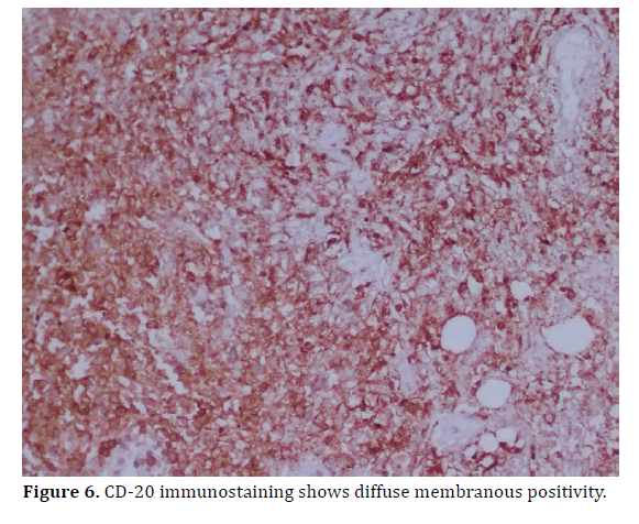 pancreas-immunostaining