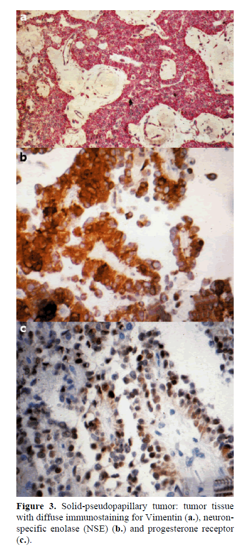 pancreas-immunostaining-vimentin