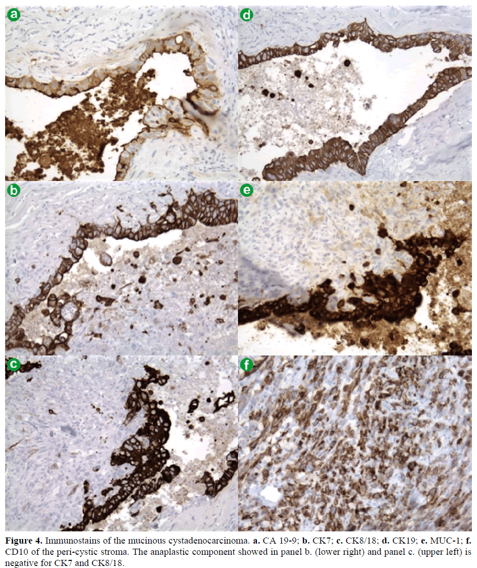 pancreas-immunostains-mucinous