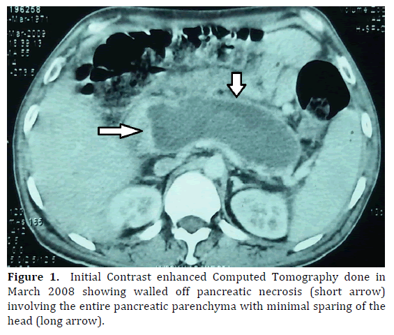 pancreas-initial-contrast-enhanced