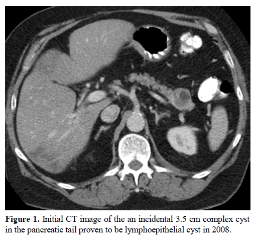 pancreas-initial-ct-image-incidental