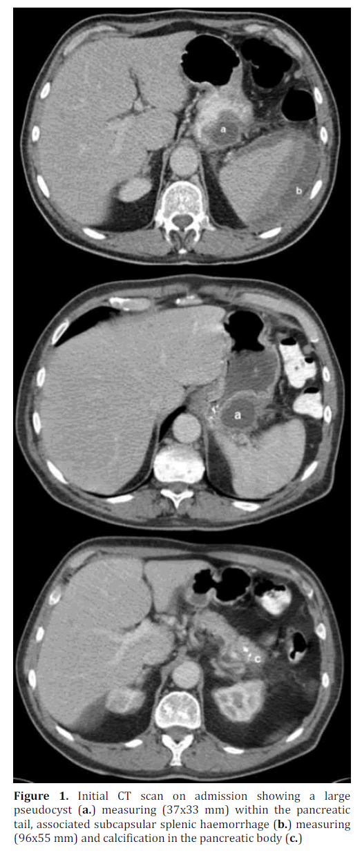 pancreas-initial-ct-scan-admission