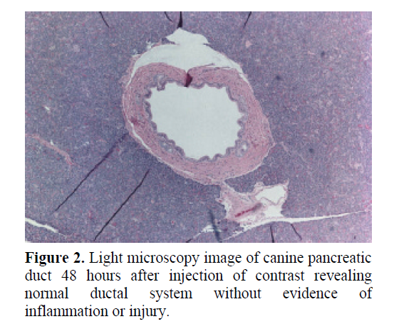 pancreas-injection-contrast-revealing