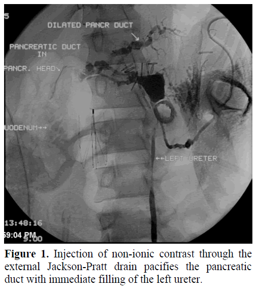 pancreas-injection-non-ionic-contrast