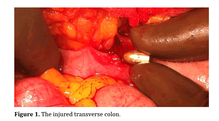 pancreas-injured-transverse-colon