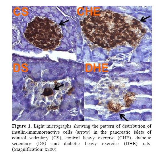 pancreas-insulin-immunoreactive