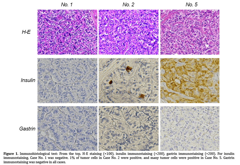 pancreas-insulin-immunostaining