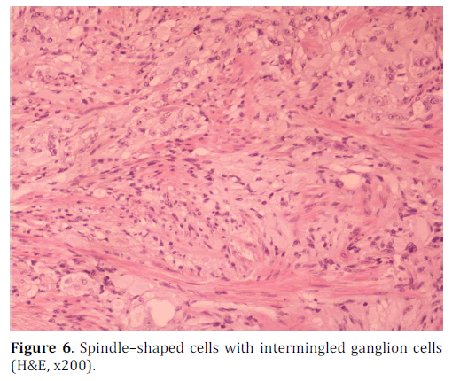 pancreas-intermingled-ganglion-cells