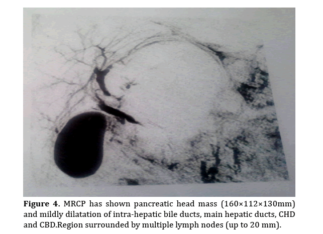 pancreas-intra-hepatic-bile-ducts