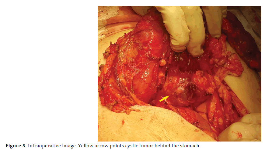 pancreas-intraoperative-image-yellow