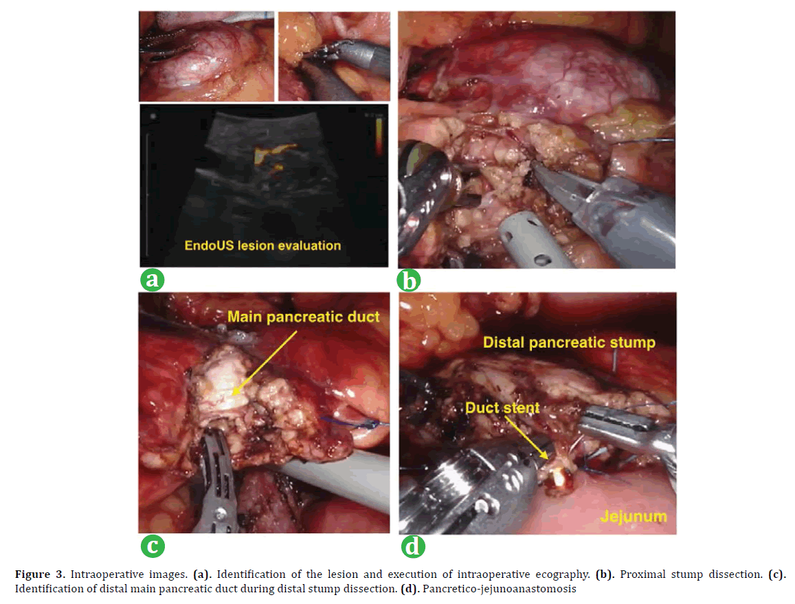 pancreas-intraoperative-images