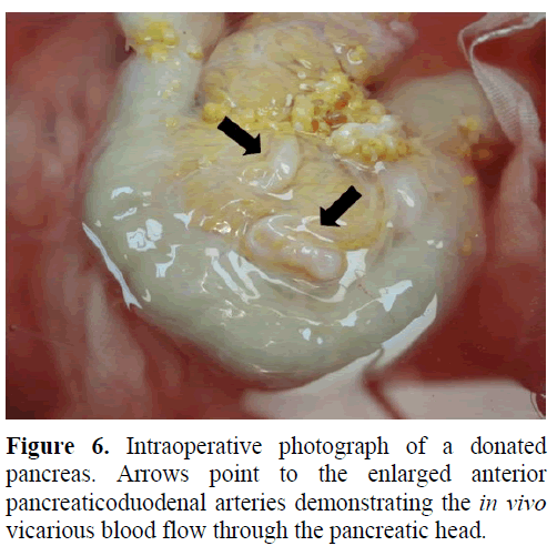 pancreas-intraoperative-photograph-pancreas