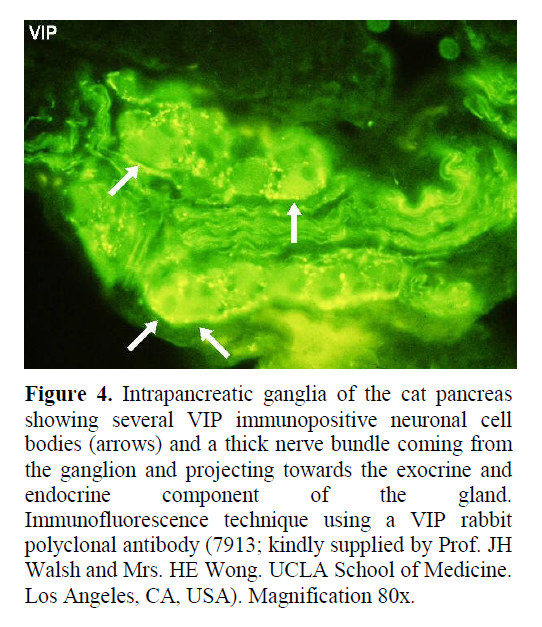 pancreas-intrapancreatic-ganglia