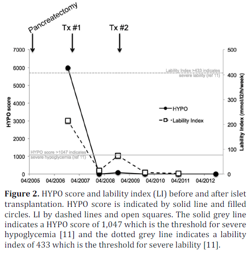pancreas-lability-transplantation-hypoglycemia