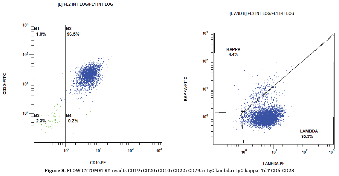 pancreas-lambda