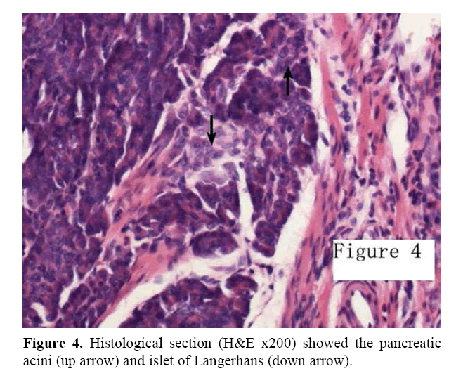 pancreas-langerhans-down-arrow