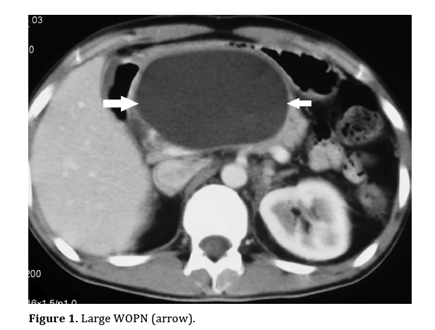 pancreas-large-WOPN