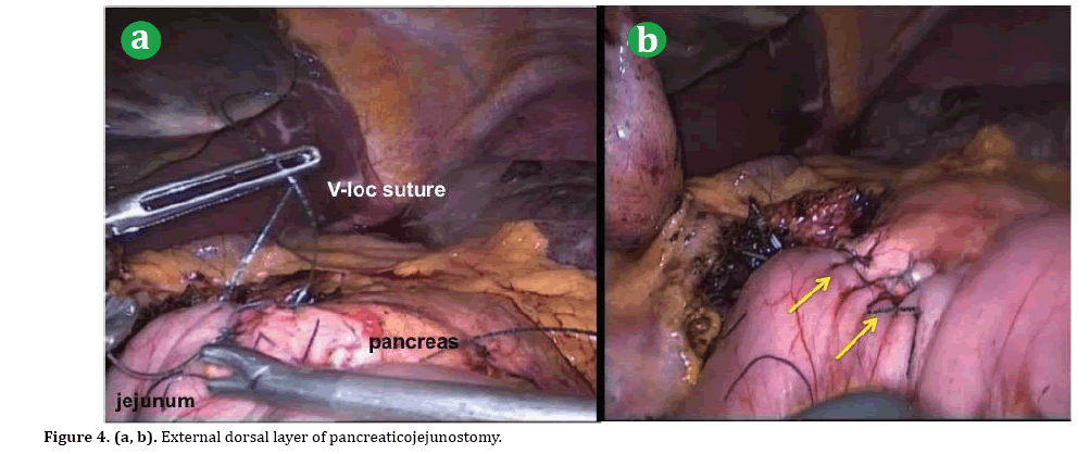 pancreas-layer