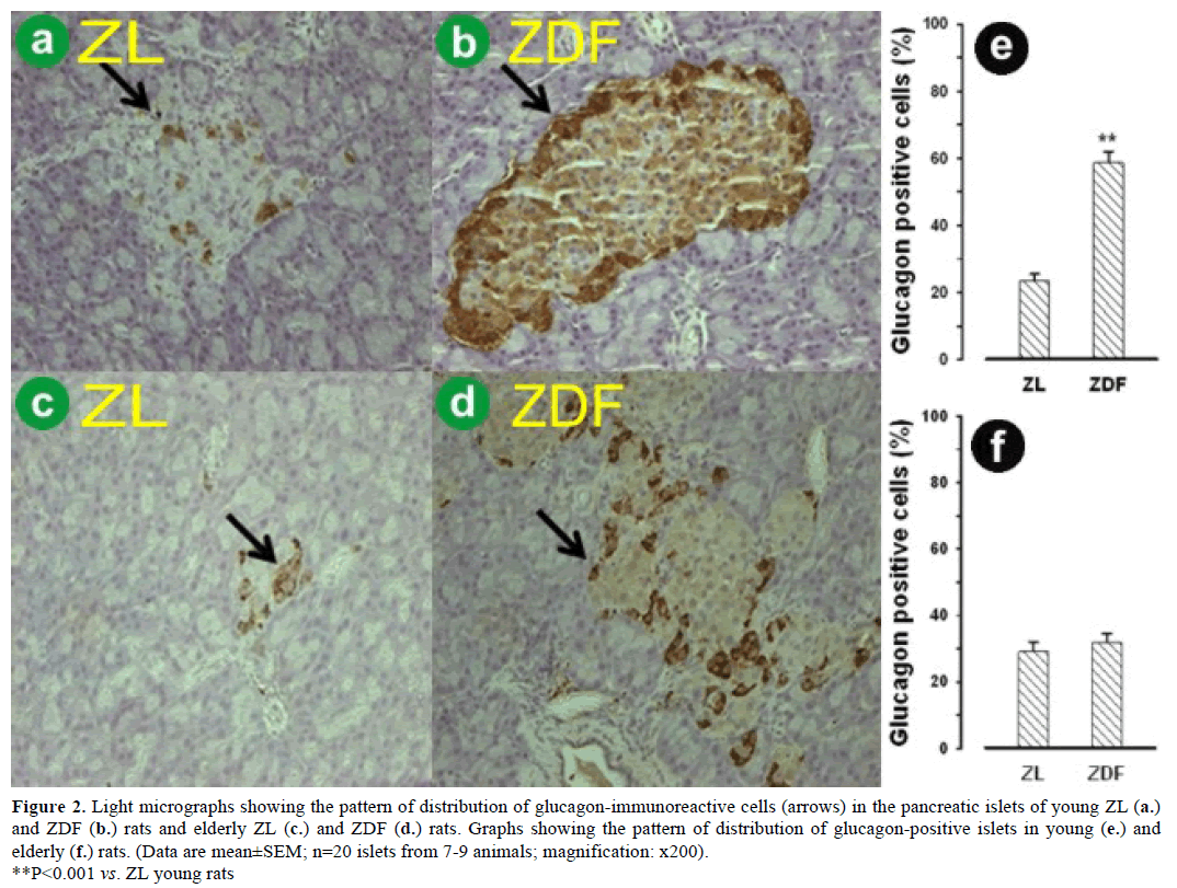 pancreas-light-micrographs-glucagon