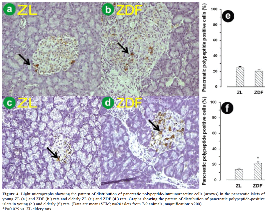 pancreas-light-micrographs-polypeptide