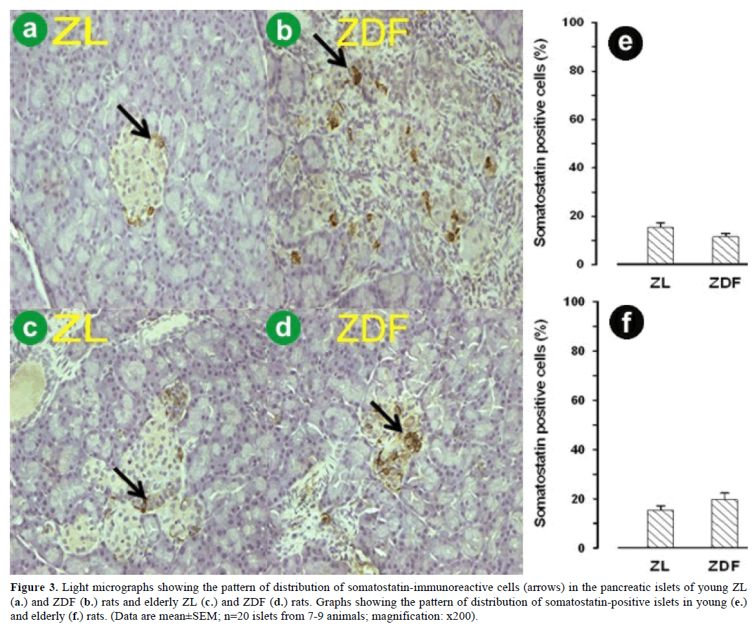 pancreas-light-micrographs-somatostatin