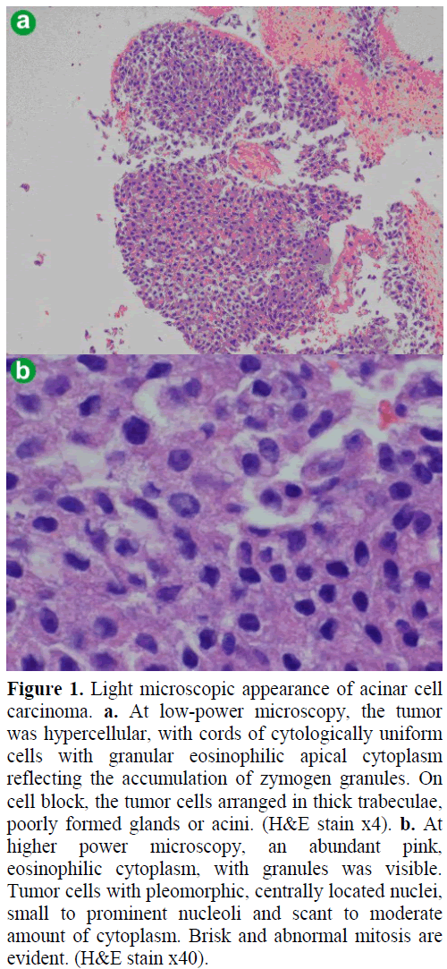 pancreas-light-microscopic-appearance