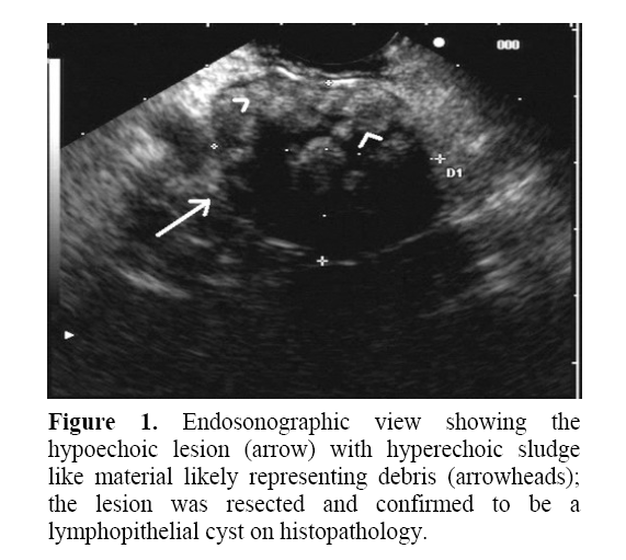 pancreas-likely-representing-debris