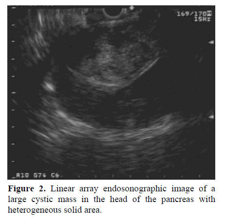 pancreas-linear-array-endosonographic