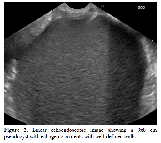 pancreas-linear-echoendoscopic-image