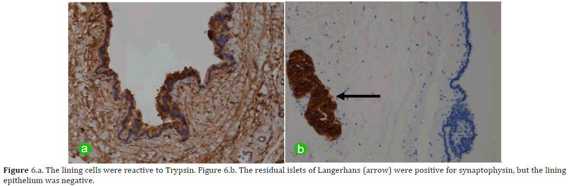 pancreas-lining-cells-trypsin