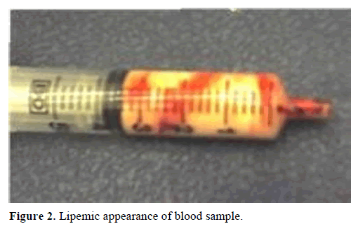 pancreas-lipemic-appearance-blood-sample