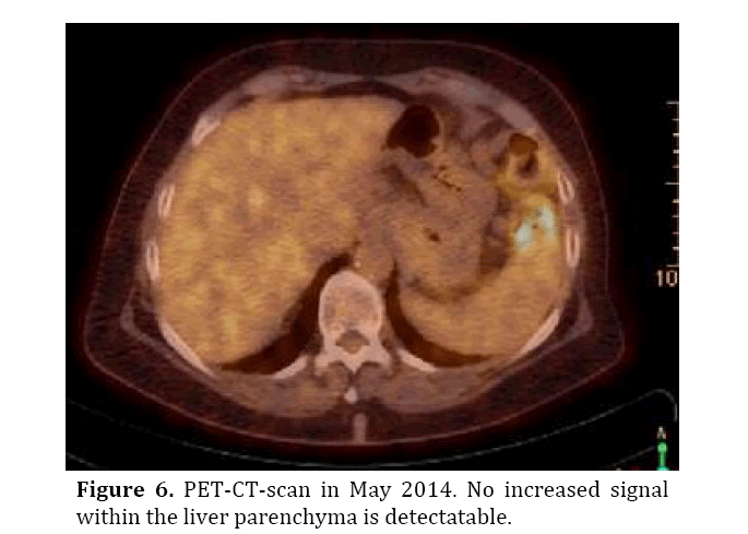 pancreas-liver-parenchyma-detectatable