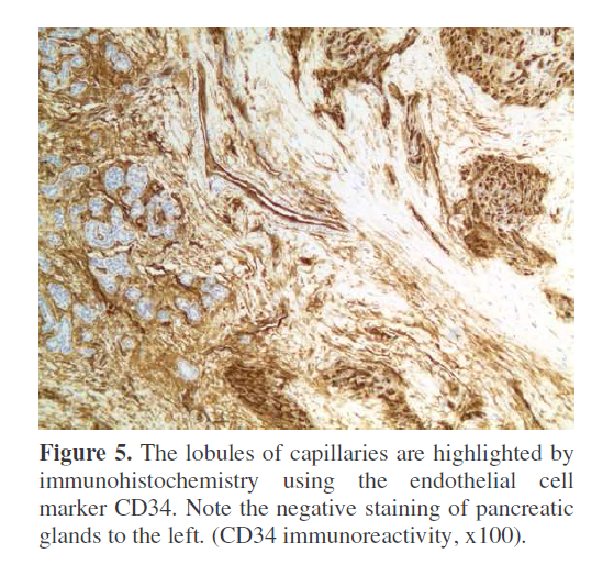 pancreas-lobules-capillaries-highlighted