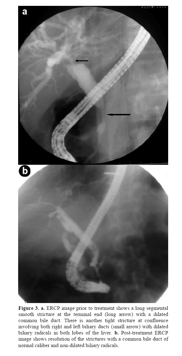 pancreas-long-segmental