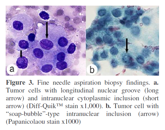 pancreas-longitudinal-nuclear-groove