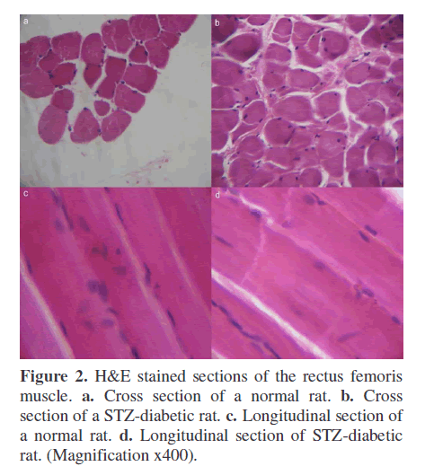 pancreas-longitudinal-section-STZ-diabetic