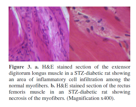 pancreas-longitudinal-section-STZ-diabetic