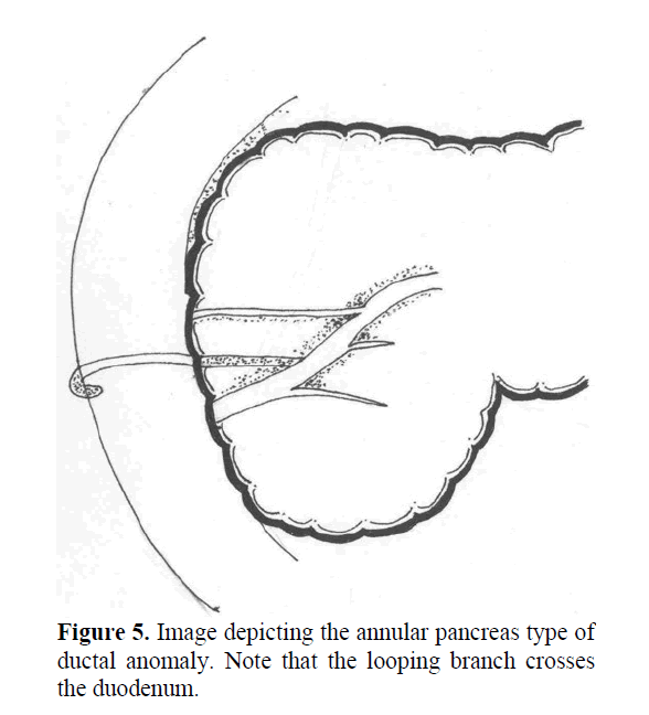 pancreas-looping-branch-crosses