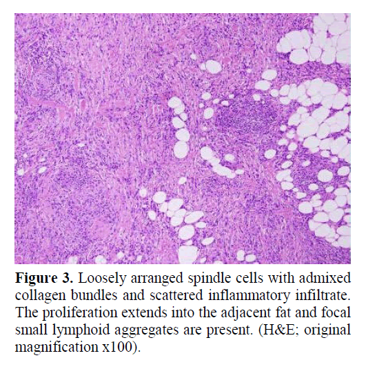 pancreas-loosely-arranged-spindle