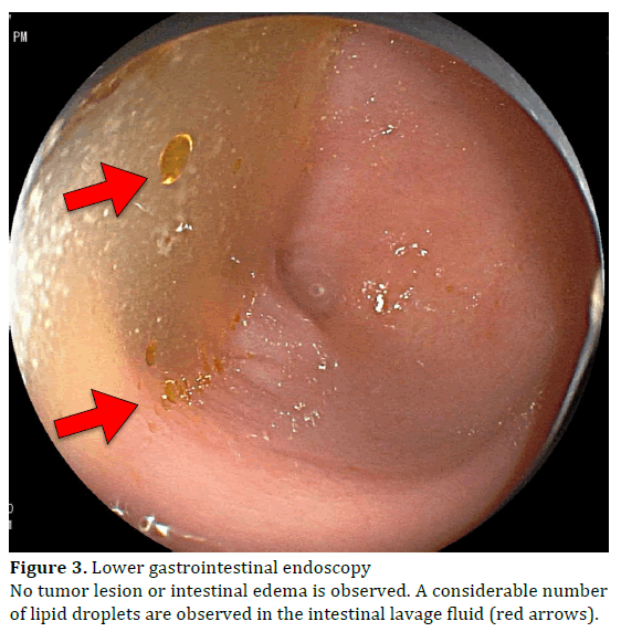 pancreas-lower-gastrointestinal-endoscopy