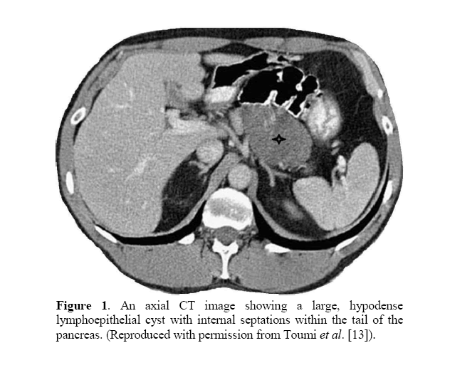 pancreas-lymphoepithelial-cyst