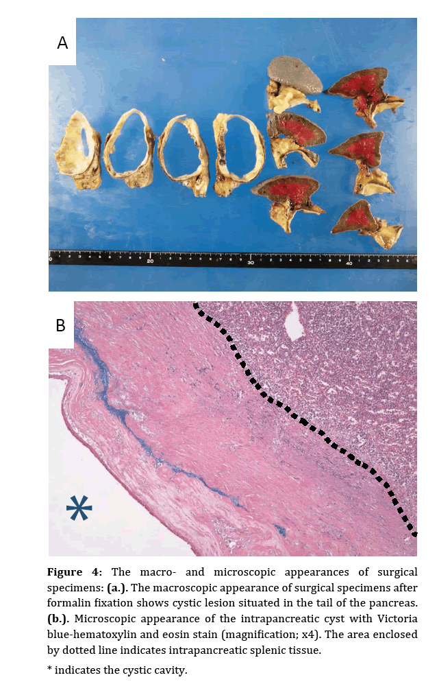 pancreas-macroscopic-appearance